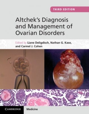 Altchek's Diagnosis and Management of Ovarian Disorders фото книги