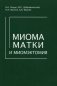 Миома матки и миомэктомия фото книги маленькое 2