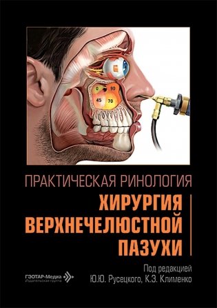 Практическая ринология: хирургия верхнечелюстной пазухи фото книги
