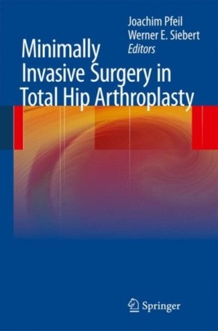 Minimally Invasive Surgery in Total Hip ArthroplastyMinimally Invasive Surgery in Total Hip Arthroplasty фото книги