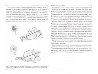 Аппендицит фото книги 2