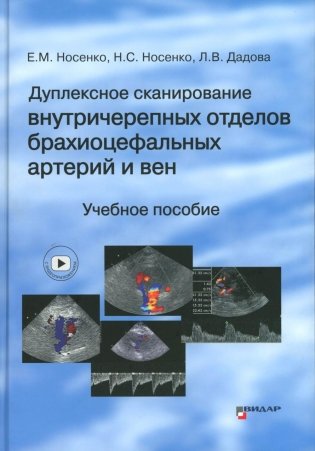 Дуплексное сканирование внутричерепных отделов брахиоцефальных артерий и вен. Учебное пособие фото книги