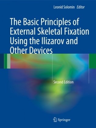 The Basic Principles of External Skeletal Fixation Using the Ilizarov and Other Devices фото книги