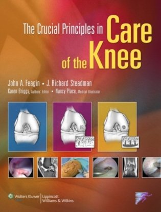 The Crucial Principles in Care of the Knee фото книги