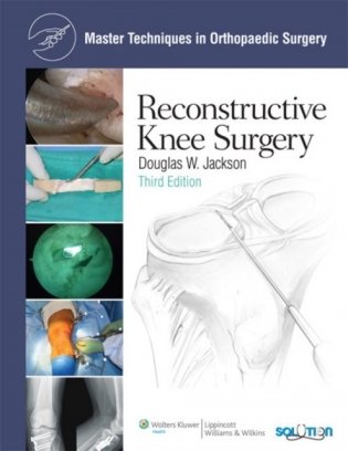 Mtos: recon knee surgery 3e cb фото книги