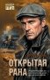 Открытая рана фото книги маленькое 2