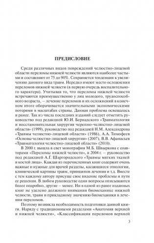 Травмы и восстановительная хирургия челюстно-лицевой области фото книги 4