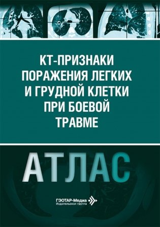 КТ-признаки поражения легких и грудной клетки при боевой травме: атлас фото книги