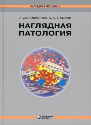 Наглядная патология. 2-е изд фото книги