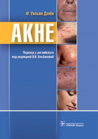 Акне фото книги