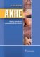 Акне фото книги маленькое 2
