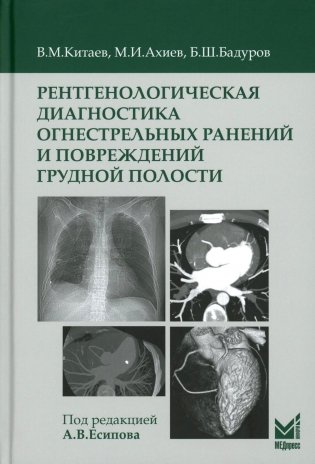Рентгенологическая диагностика огнестрельных ранений и повреждений грудной полости. 2-е изд., перераб. и доп фото книги