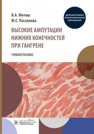 Высокие ампутации нижних конечностей при гангрене. Учебное пособие фото книги