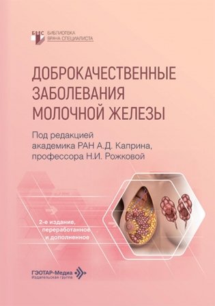 Доброкачественные заболевания молочной железы. 2-е изд., перераб. и доп фото книги