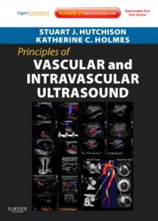Principles of Vascular and Intravascular Ultrasound фото книги