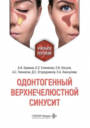 Одонтогенный верхнечелюстной синусит : учебное пособие фото книги
