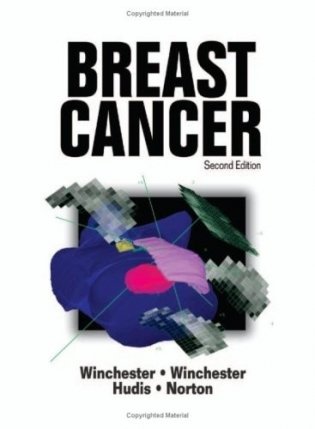Breast Cancer, 2nd edition фото книги