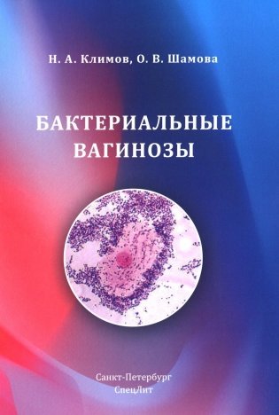 Бактериальные вагинозы фото книги