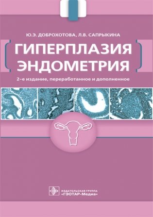 Гиперплазия эндометрия фото книги