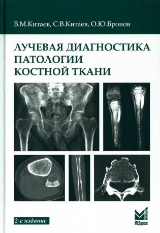 Лучевая диагностика патологии костной ткани. 2-е изд фото книги