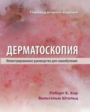 Дерматоскопия. Иллюстрированное руководство для самообучения фото книги