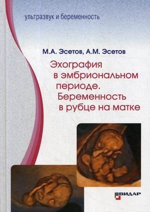 Эхография в эмбриональном периоде. Беременность в рубце на матке фото книги
