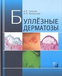 Буллёзные дерматозы фото книги