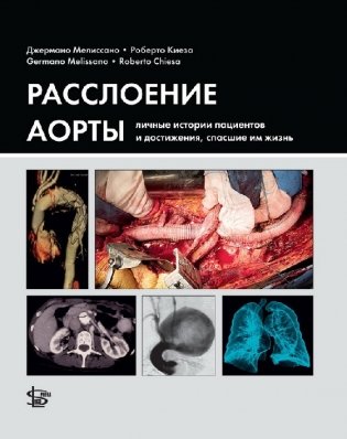Расслоение аорты: личные истории пациентов и достижения, спасшие им жизнь фото книги