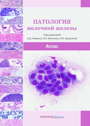 Патология молочной железы. Атлас фото книги