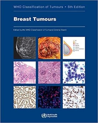 Breast Tumours фото книги
