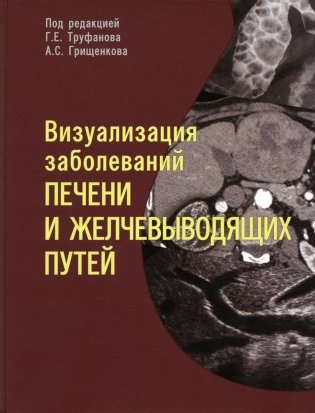 Визуализация заболеваний печени и желчевыводящих путей: Учебное пособие фото книги