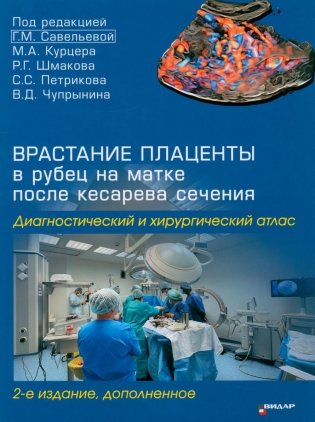 Врастание плаценты в рубец на матке после кесарева сечения. Диагностический и хирургический атлас. 2-е изд., доп фото книги