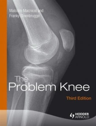 The Problem Knee, Third Edition фото книги