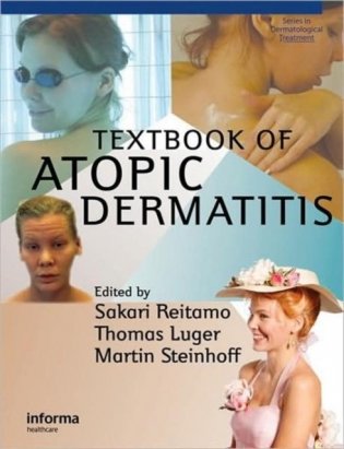 Textbook Atopic Dermatitis фото книги