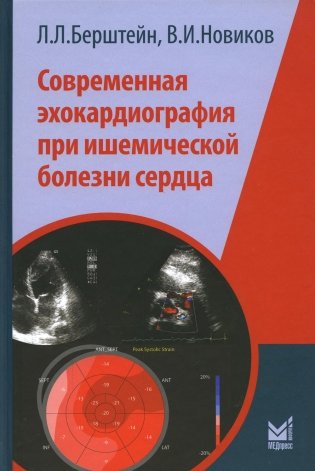 Современная эхокардиография при ишемической болезни сердца фото книги