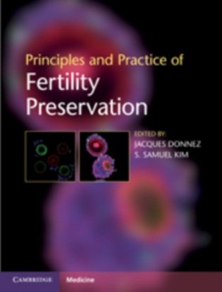 Principles and Practice of Fertility Preservation фото книги