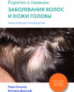 Коротко о главном: заболевание волос и кожи головы. Практическое руководство фото книги