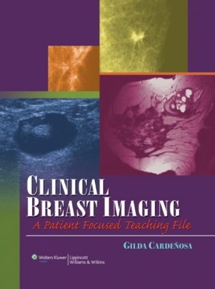Clinical Breast Imaging: A Patient Focused Teaching Atlas фото книги
