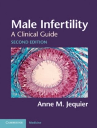Male Infertility фото книги
