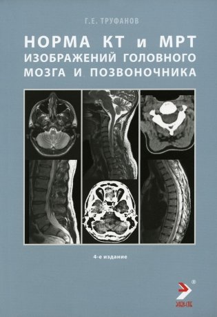 Норма КТ- и МРТ- изображений головного мозга и позвоночника: атлас изображений. 4-е изд фото книги