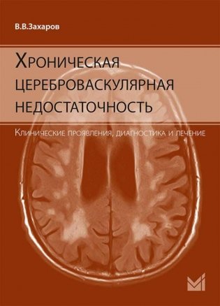 Хроническая цереброваскулярная недостаточность. 4-е изд., перераб.и доп фото книги