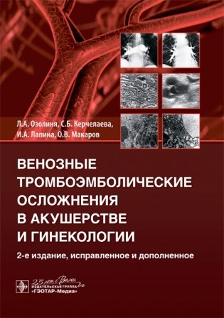 Венозные тромбоэмболические осложнения в акушерстве и гинекологии фото книги