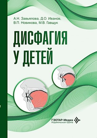 Дисфагия у детей фото книги