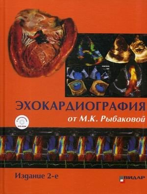Эхокардиография от М.К. Рыбаковой. Руководство (+ DVD) фото книги