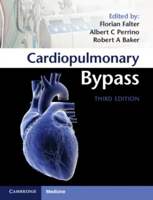 Cardiopulmonary Bypass фото книги