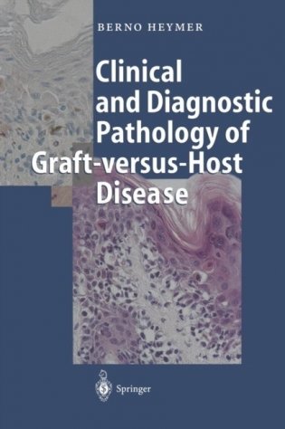 Clinical and Diagnostic Pathology of Graft-versus-Host Disease фото книги