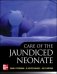Care of the Neonatal Jaundice фото книги маленькое 2