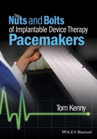 The Nuts and Bolts of Implantable Device Therapy: Pacemakers фото книги