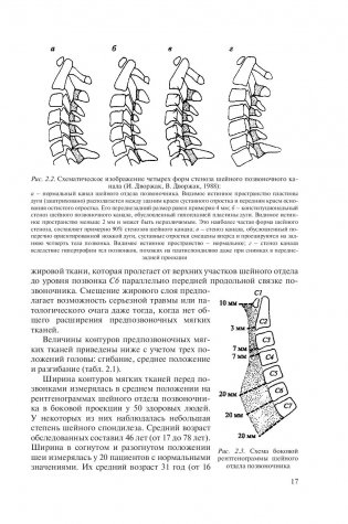 Рентгенометрия позвоночника фото книги 17