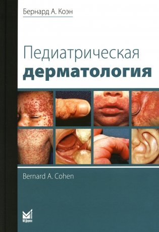 Педиатрическая дерматология. 3-е изд фото книги